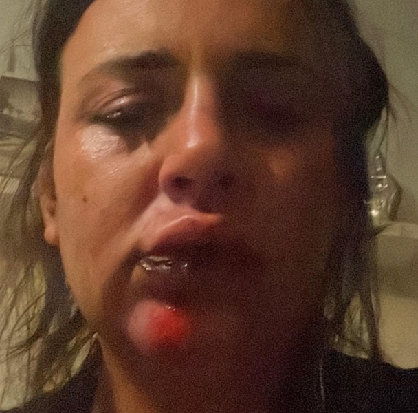 Футболіст жорстоко побив свою дівчину: щоб урятуватися, та вистрибнула з балкона (фото, відео)